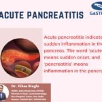 Acute Pancreatits