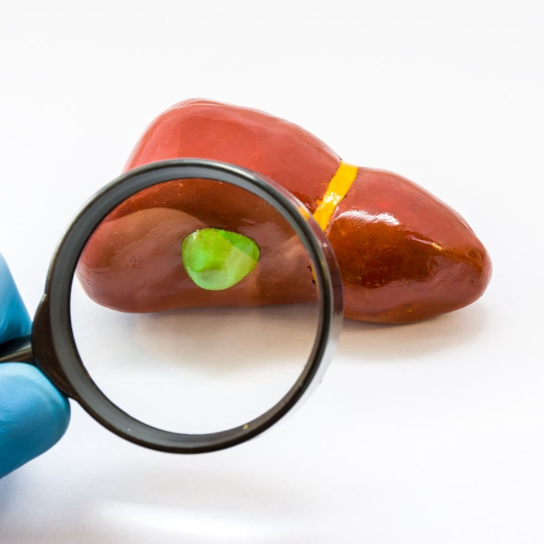 Cancer in Gallbladder