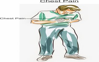 Chest-Pain-Image