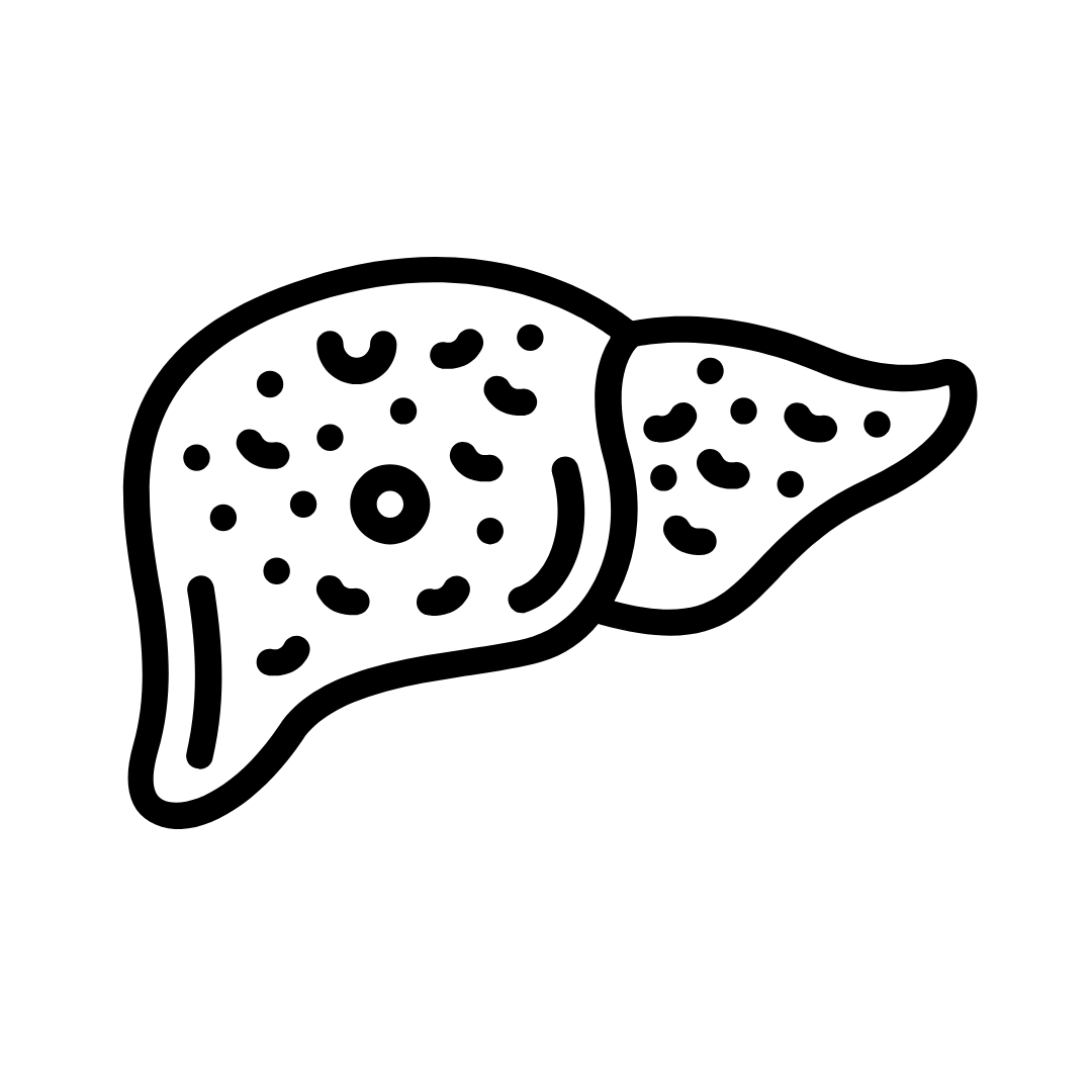 Cirrhosis