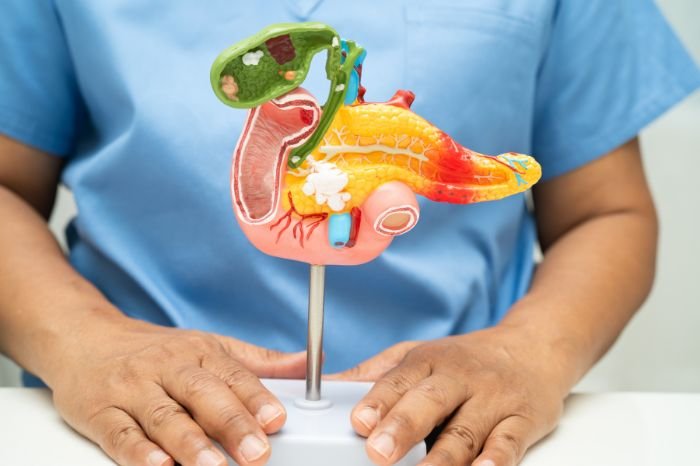 Common Bile Duct Stone