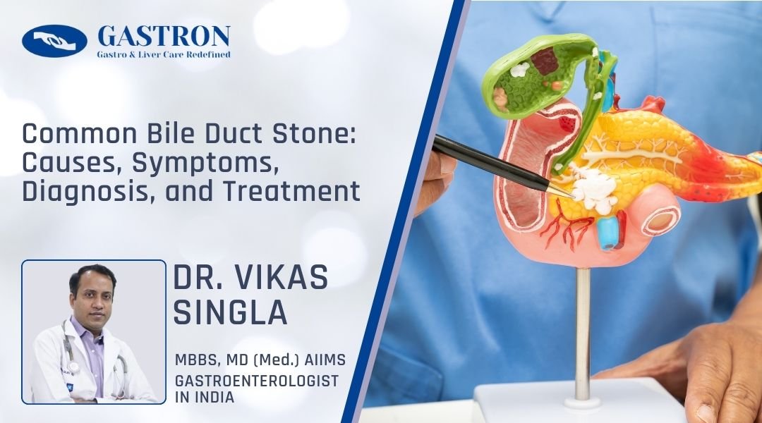 Common Bile Duct Stone Causes, Symptoms, Diagnosis, and Treatment