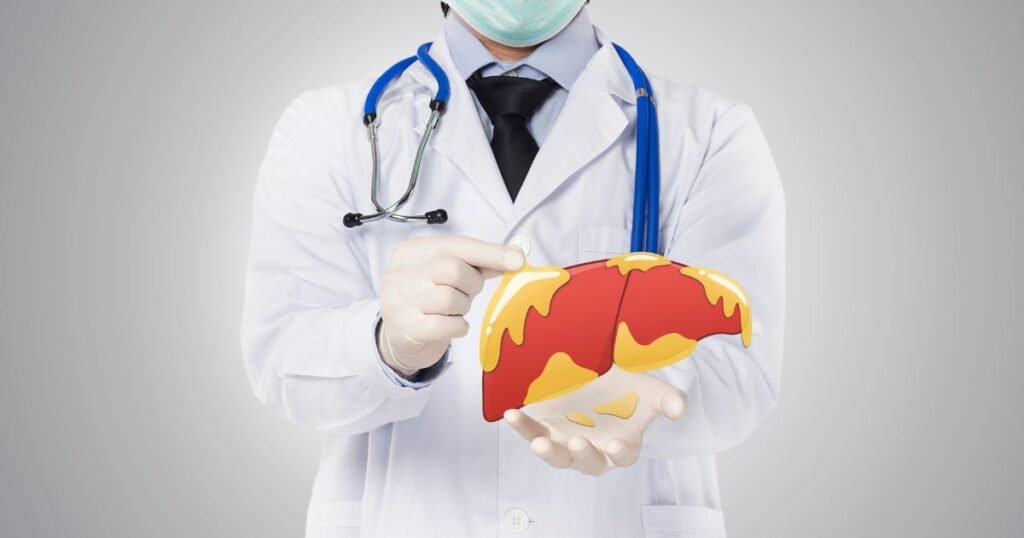 Non-Alcoholic Fatty Liver Disease