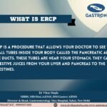 ERCP: About, Need and Use