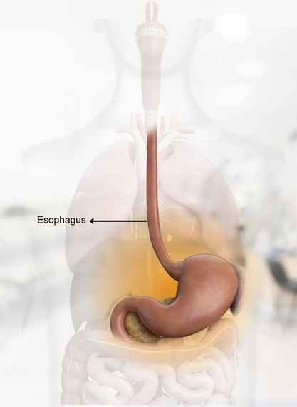 Esophageal Disorders