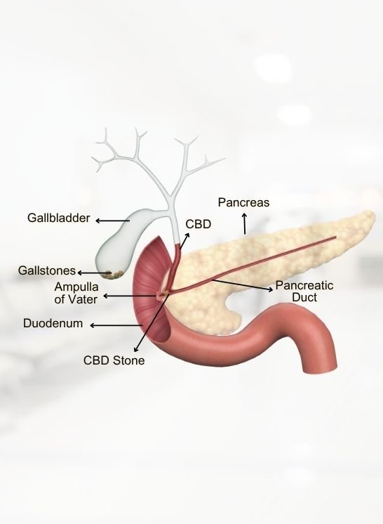 Gallbladder &Amp; Bile Duct Diseases (1)