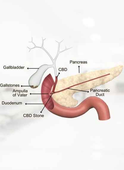 Gallbladder &Amp; Bile Duct Diseases