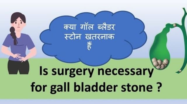 Gallbladder Stones (Pathari) Symptoms, Treatment & Surgery