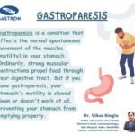 Gastroparesis: Symptoms, Risk Factors, Types, Complications, and Treatment