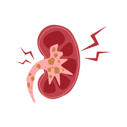 Heart Or Kidney Failure