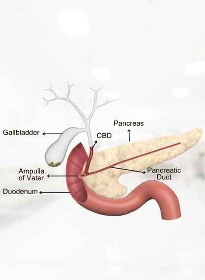 Pancreatic Diseases