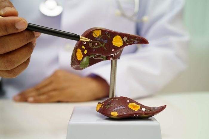 Pancreatic Pseudocyst