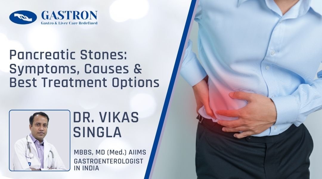 Pancreatic Stones Symptoms, Causes & Best Treatment Options