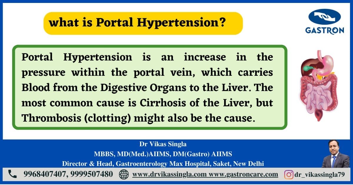 Portal Hypertension