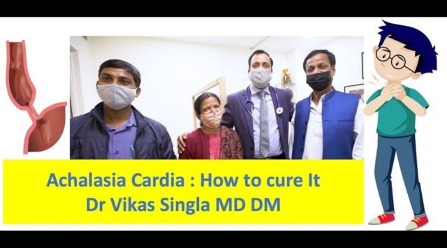 Understanding Achalasia Cardia and the Role of Esophageal Manometry in Diagnosis