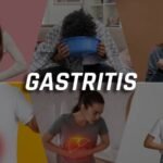 Understanding Gastritis  Causes Symptoms and Management