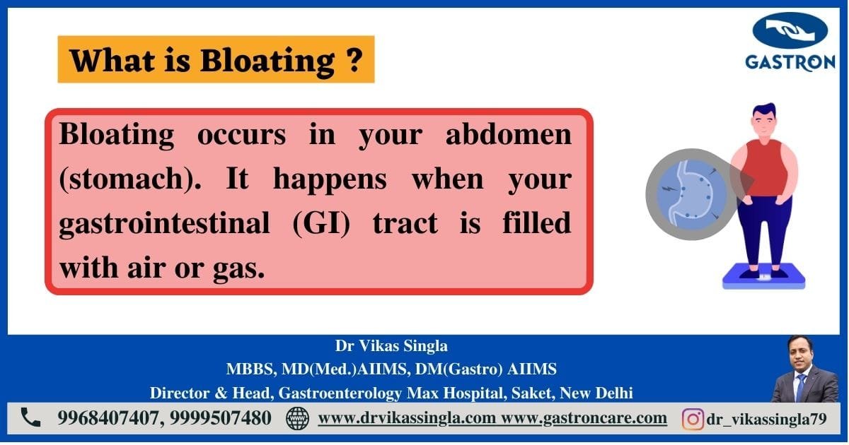 Bloating - Causes, Symptoms and Treatments - Dr Vikas Singla - Gastroentrologist