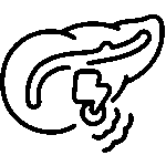 Mild Acute Pancreatitis Mild Acute Pancreatitis