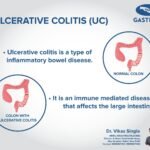 Ulcerative Colitis (UC)